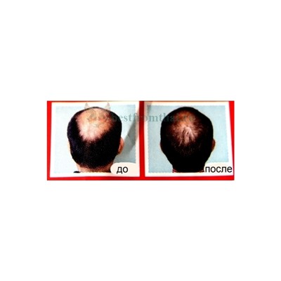 Шампунь от выпадения волос Bio Herbal Anti-Hair Loss 500мл