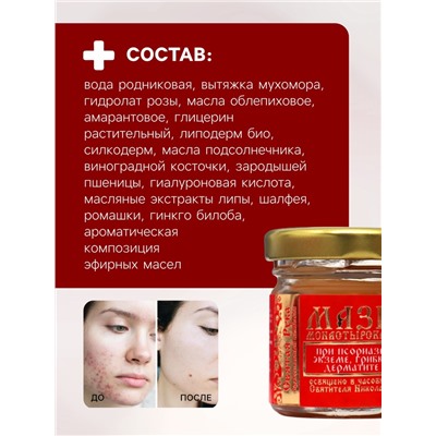 Мазь при псориазе, экземе, грибке, дерматите «Святая Рука», 30 мл