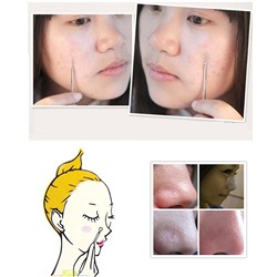 Инструмент для удаления чёрных точек и чистки пор