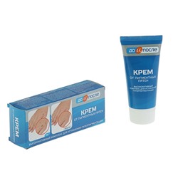 Крем «До и после» от пигментных пятен, 50 мл