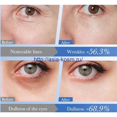 Регенерирующий крем для глаз Sadoer от темных кругов c экстрактом красной икры и гиалуроновой кислотой(19332)