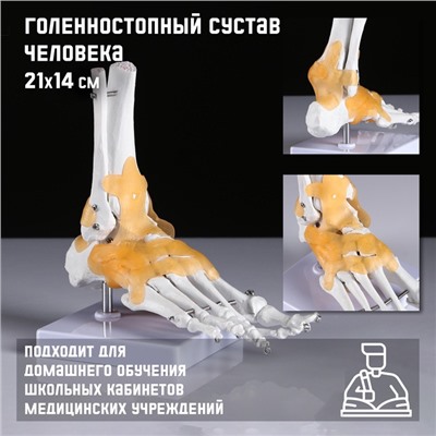 Анатомическая модель «Макет голеностопного сустава», 21×20 см