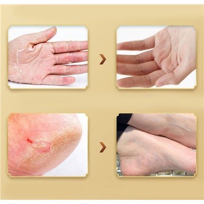 Смягчающий бальзам для сухих участков с лошадиным жиром Jintaikang, 80 гр.