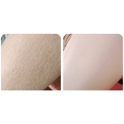 Крем увлажняющий с мочевиной и витамином Е Bioaqua Vitamin E Urea Cream, 170 гр.