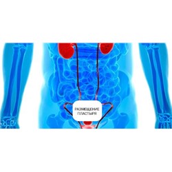 До 2025.10 Пластырь от простатита "Prostatic Navel Plasters"