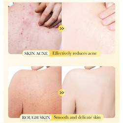 Серное мыло антибактериальное для проблемной кожи Sadoer Sulfur Soap, 125 гр.