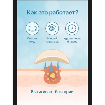 Патчи от прыщей (3678)