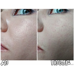 Матирующий абсорбирующий многоразовый роллер из вулканического камня против жирного блеска на лице