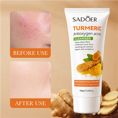 Пенка для лица антиоксидантная с куркумой SADOER TURMERIC Antioxygen acnes CLEANCER, 100 гр