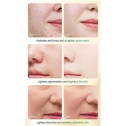 Пилинг-сыворотка для лица с яблочной и цитрусовой кислотами MOOYAM TCA Peel Serum, 30 мл.