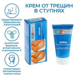Крем для ног «До и После» от трещин в ступнях, 150 мл