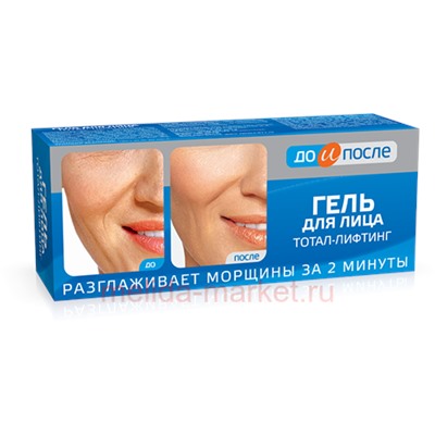 ДО И ПОСЛЕ ГЕЛЬ ДЛЯ ЛИЦА ТОТАЛ-ЛИФТИНГ 50МЛ
