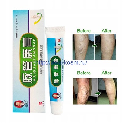 Мазь "Май Гуань Кан Гао" (MaiGuanKangGao) от варикоза и васкулита.