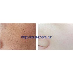 Отбеливающая, омолаживающая маска Sadoer с ниацинамидом (90078)