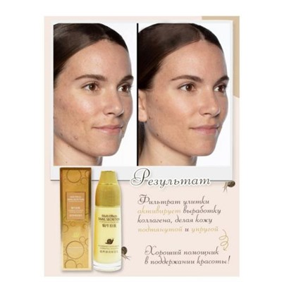 Эмульсия для лица с муцином улитки Multi Effects SNAIL SECRETION 120 ml