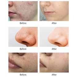 Обновляющий пилинг-тоник с 7% гликолевой кислоты MOOYAM Glycolic Acid 7%, 250 мл.