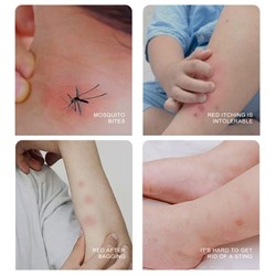 Бальзам от укусов насекомых в стике ZOO-SON Refreshing comfrey oinment, 7,4 гр.