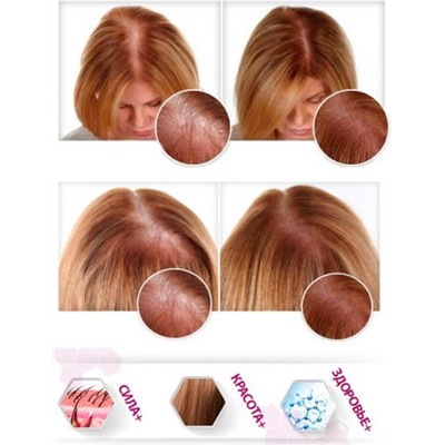 Тричуп травяные капсулы против выпадения волос (Trichup Hair Nourisher), 100 капс.