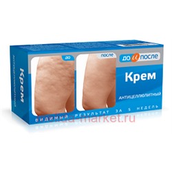 До и после Крем Антицеллюлитный 100мл