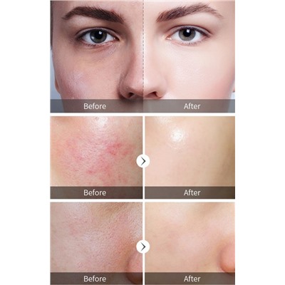 Мягкий всесезонный пилинг с AHA/BHA кислотами Mooyam, 30 мл.