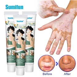 Крем против пигментных пятен Sumifun Vitiligo Cream 20гр