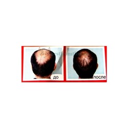 Шампунь от выпадения волос Bio Herbal Anti-Hair Loss 220мл